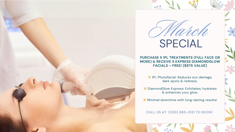 March Specials